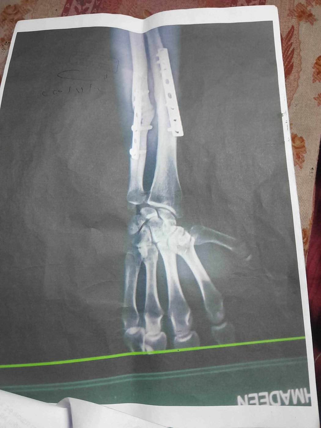 Medical X-ray photograph